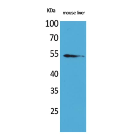 Western blot - MDM2 Polyclonal Antibody from Signalway Antibody (41595) - Antibodies.com