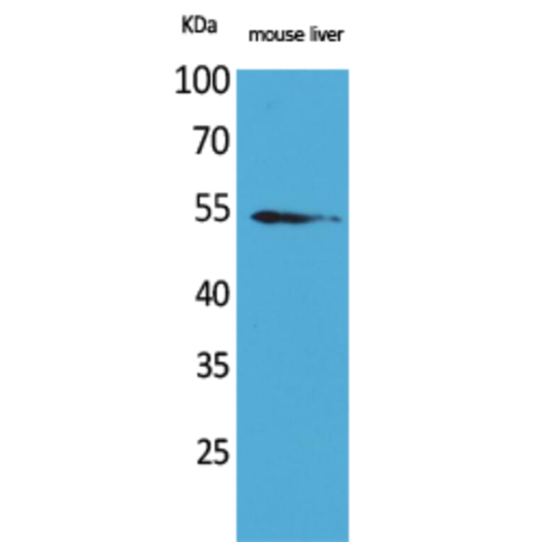 Western blot - MDM2 Polyclonal Antibody from Signalway Antibody (41595) - Antibodies.com