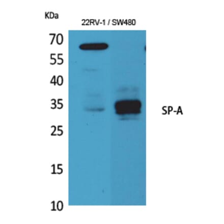 Western blot - SP-A Polyclonal Antibody from Signalway Antibody (41600) - Antibodies.com