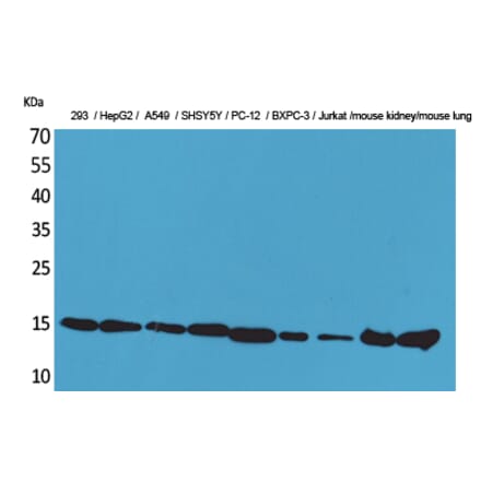 Western blot - CyPA Polyclonal Antibody from Signalway Antibody (41606) - Antibodies.com