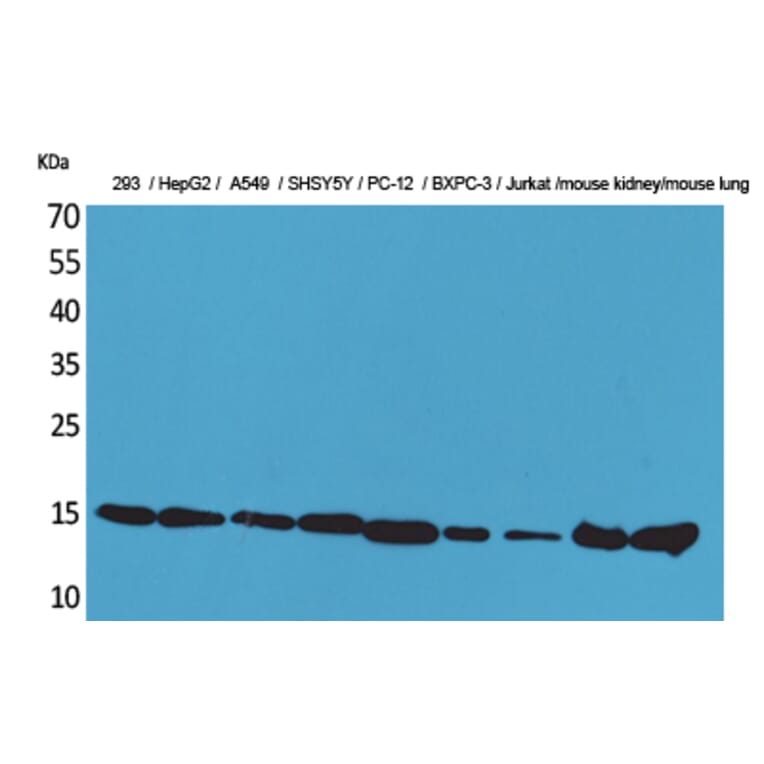 Western blot - CyPA Polyclonal Antibody from Signalway Antibody (41606) - Antibodies.com