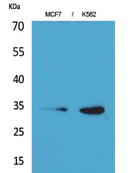 Western Blot analysis of MCF7 K562 cells using Cdk4 Polyclonal Antibody