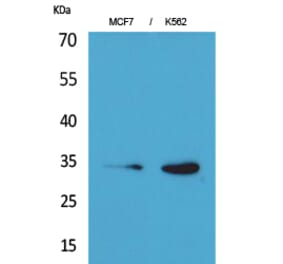 Western blot - Cdk4 Polyclonal Antibody from Signalway Antibody (41607) - Antibodies.com