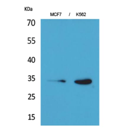 Western blot - Cdk4 Polyclonal Antibody from Signalway Antibody (41607) - Antibodies.com