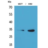 Western blot - Cdk4 Polyclonal Antibody from Signalway Antibody (41607) - Antibodies.com