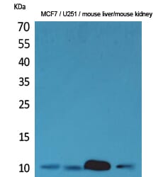 Western Blot analysis of MCF7 U251 mouse liver mouse kidney cells using ACBP Polyclonal Antibody