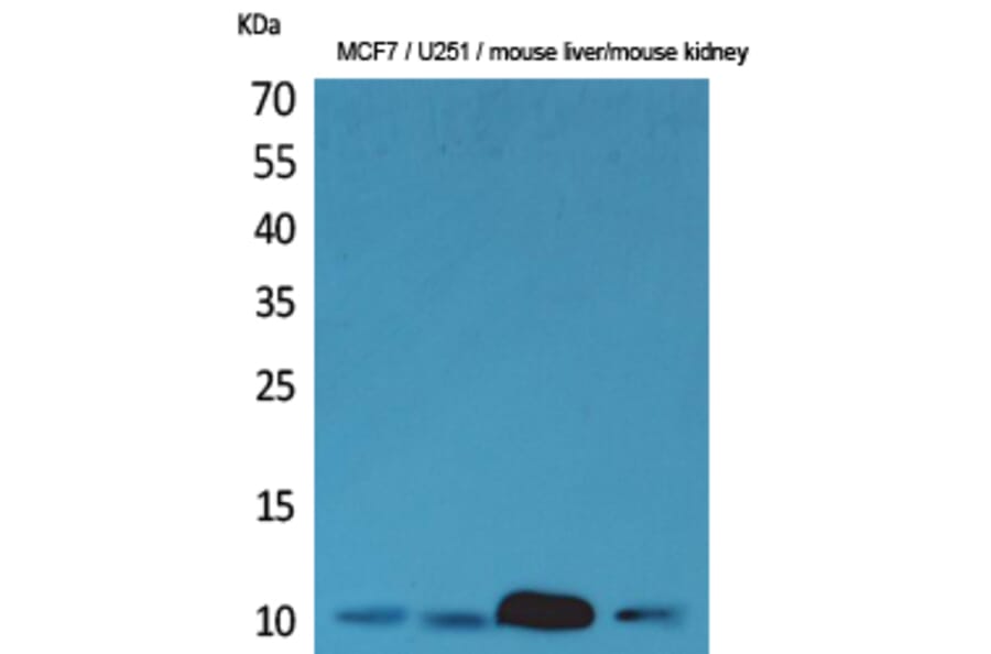 Western blot - ACBP Polyclonal Antibody from Signalway Antibody (41608) - Antibodies.com