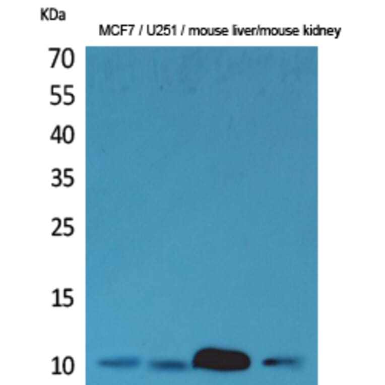 Western blot - ACBP Polyclonal Antibody from Signalway Antibody (41608) - Antibodies.com