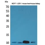 Western blot - ACBP Polyclonal Antibody from Signalway Antibody (41608) - Antibodies.com