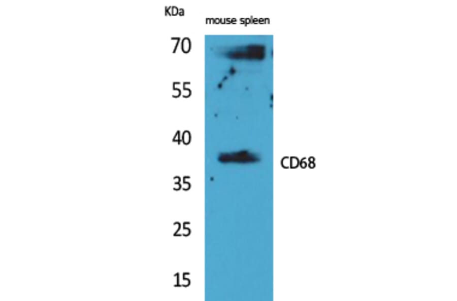 Western blot - CD68 Polyclonal Antibody from Signalway Antibody (41618) - Antibodies.com
