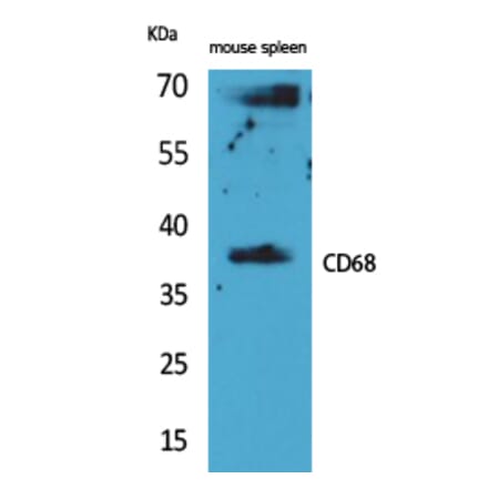 Western blot - CD68 Polyclonal Antibody from Signalway Antibody (41618) - Antibodies.com
