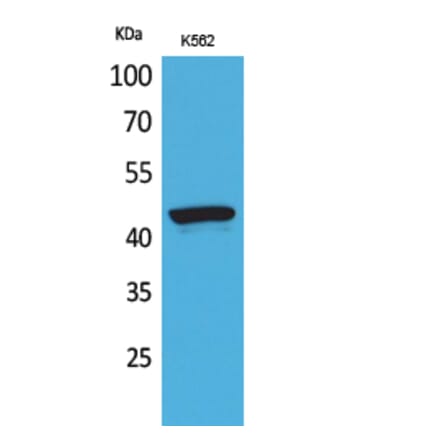 Western blot - P2X3 Polyclonal Antibody from Signalway Antibody (41619) - Antibodies.com