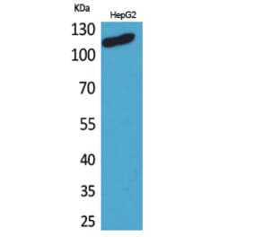 Western blot - DPYD Polyclonal Antibody from Signalway Antibody (41635) - Antibodies.com