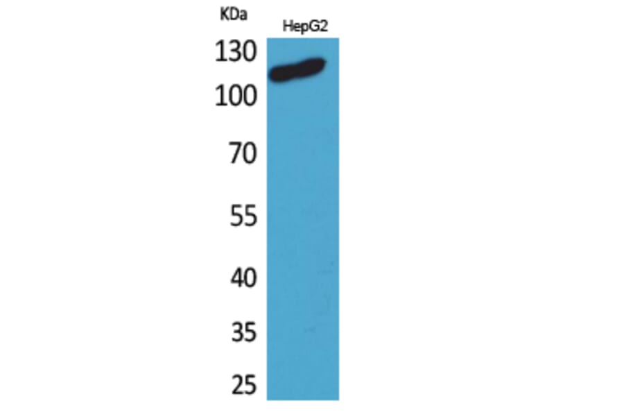 Western blot - DPYD Polyclonal Antibody from Signalway Antibody (41635) - Antibodies.com