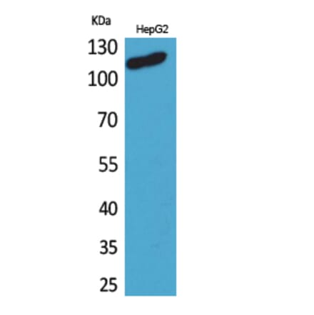Western blot - DPYD Polyclonal Antibody from Signalway Antibody (41635) - Antibodies.com