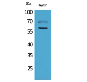 Western blot - HEXA Polyclonal Antibody from Signalway Antibody (41641) - Antibodies.com