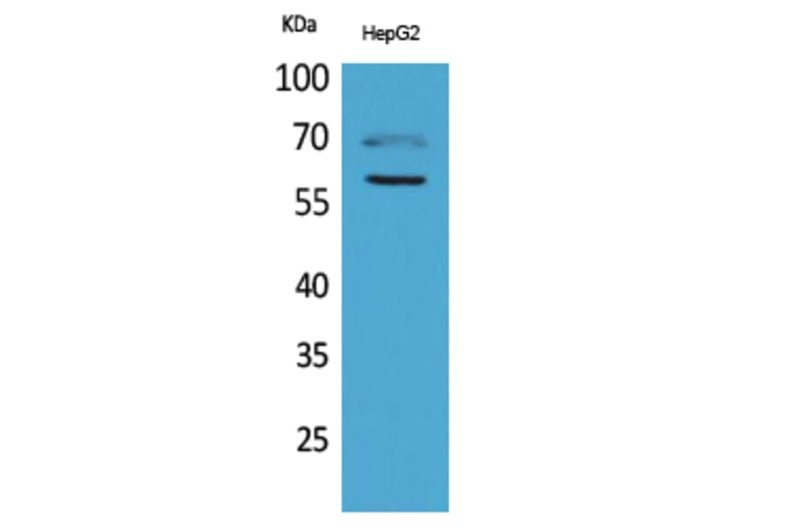 Western blot - HEXA Polyclonal Antibody from Signalway Antibody (41641) - Antibodies.com