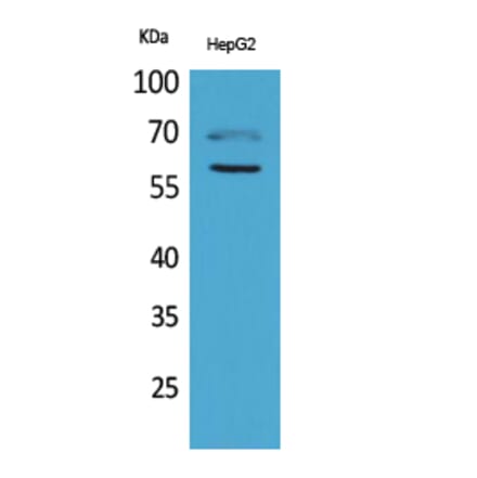 Western blot - HEXA Polyclonal Antibody from Signalway Antibody (41641) - Antibodies.com