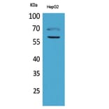 Western blot - HEXA Polyclonal Antibody from Signalway Antibody (41641) - Antibodies.com