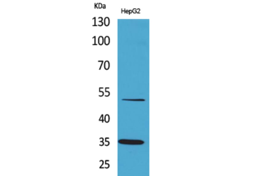 Western blot - TFPI Polyclonal Antibody from Signalway Antibody (41643) - Antibodies.com