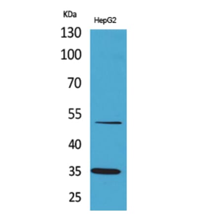 Western blot - TFPI Polyclonal Antibody from Signalway Antibody (41643) - Antibodies.com
