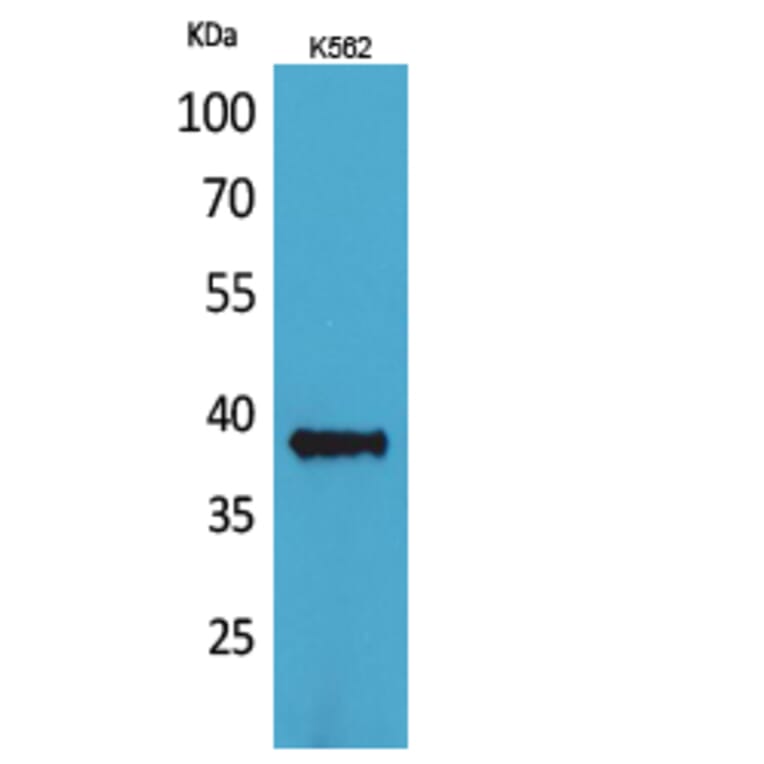 Western blot - CD1C Polyclonal Antibody from Signalway Antibody (41646) - Antibodies.com