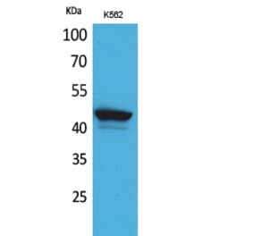 Western blot - CD1E Polyclonal Antibody from Signalway Antibody (41647) - Antibodies.com