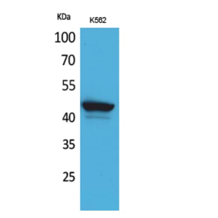 Western blot - CD1E Polyclonal Antibody from Signalway Antibody (41647) - Antibodies.com