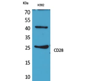 Western blot - CD28 Polyclonal Antibody from Signalway Antibody (41651) - Antibodies.com