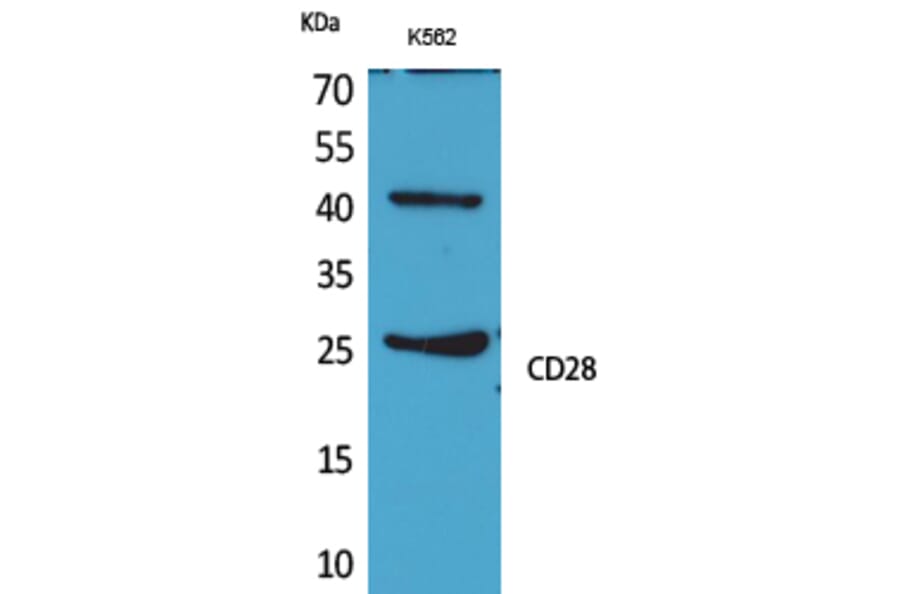 Western blot - CD28 Polyclonal Antibody from Signalway Antibody (41651) - Antibodies.com