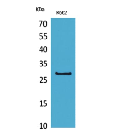 Western blot - CD58 Polyclonal Antibody from Signalway Antibody (41658) - Antibodies.com