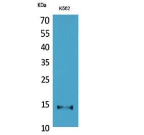 Western blot - CD59 Polyclonal Antibody from Signalway Antibody (41659) - Antibodies.com