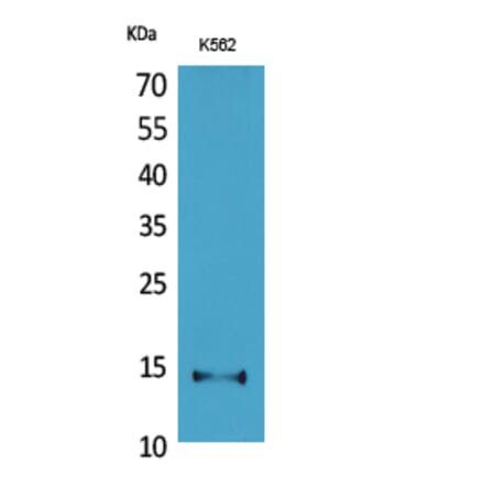 Western blot - CD59 Polyclonal Antibody from Signalway Antibody (41659) - Antibodies.com