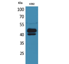 Western blot - PSG1 Polyclonal Antibody from Signalway Antibody (41660) - Antibodies.com