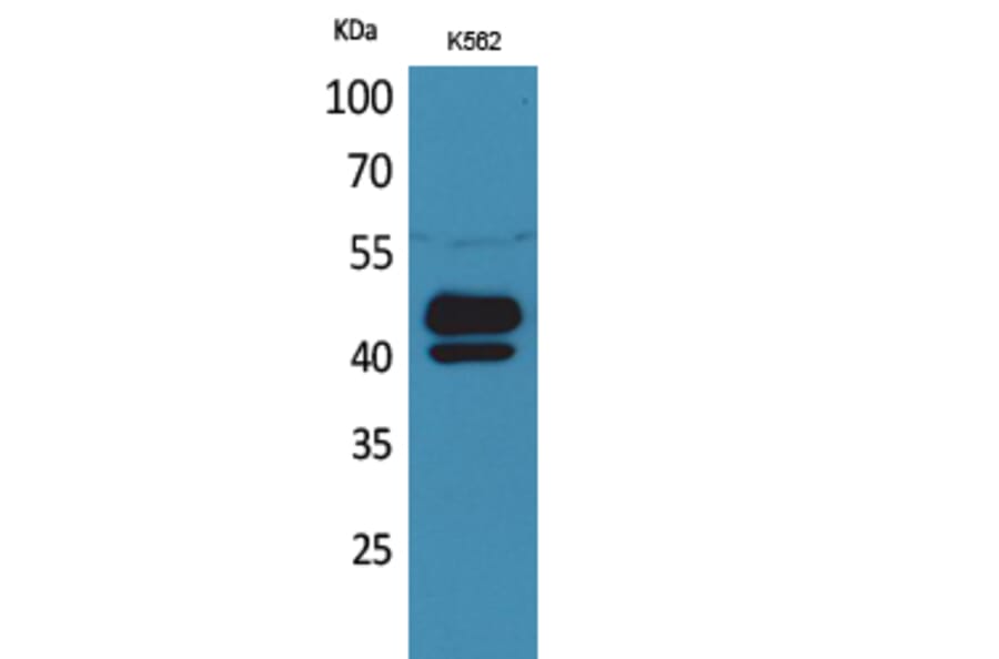 Western blot - PSG1 Polyclonal Antibody from Signalway Antibody (41660) - Antibodies.com