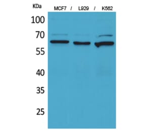 Western blot - CD73 Polyclonal Antibody from Signalway Antibody (41661) - Antibodies.com