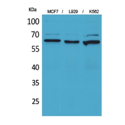 Western blot - CD73 Polyclonal Antibody from Signalway Antibody (41661) - Antibodies.com