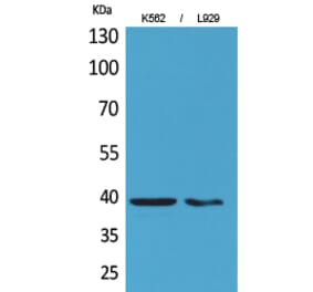 Western blot - CD84 Polyclonal Antibody from Signalway Antibody (41663) - Antibodies.com