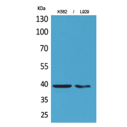 Western blot - CD84 Polyclonal Antibody from Signalway Antibody (41663) - Antibodies.com