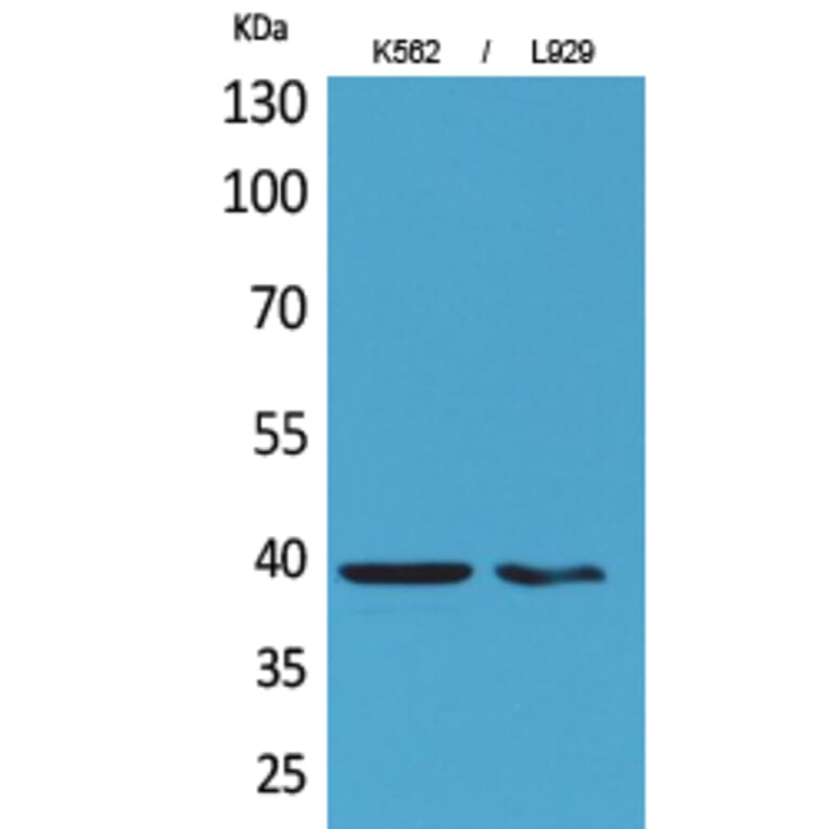 Western blot - CD84 Polyclonal Antibody from Signalway Antibody (41663) - Antibodies.com