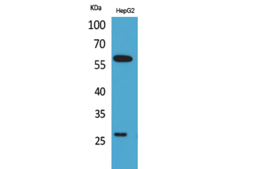 Western blot - GGT1 Polyclonal Antibody from Signalway Antibody (41673) - Antibodies.com