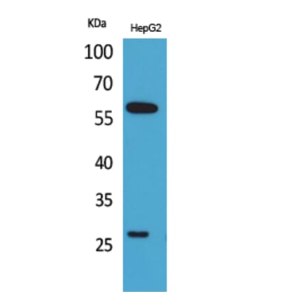 Western blot - GGT1 Polyclonal Antibody from Signalway Antibody (41673) - Antibodies.com