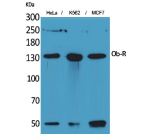 Western blot - Ob-R Polyclonal Antibody from Signalway Antibody (41688) - Antibodies.com