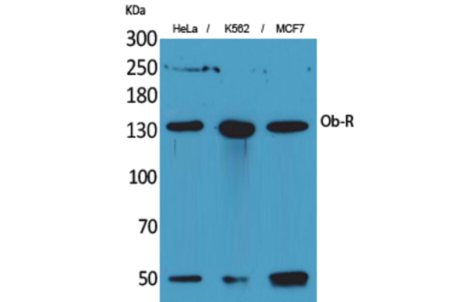 Western blot - Ob-R Polyclonal Antibody from Signalway Antibody (41688) - Antibodies.com