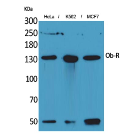 Western blot - Ob-R Polyclonal Antibody from Signalway Antibody (41688) - Antibodies.com