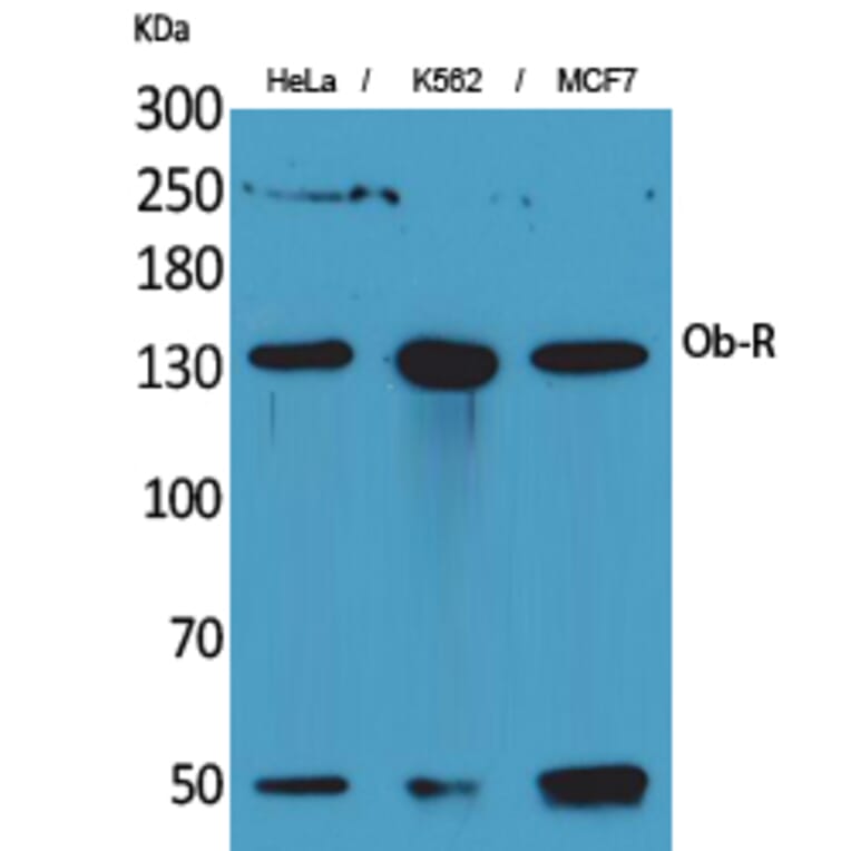 Western blot - Ob-R Polyclonal Antibody from Signalway Antibody (41688) - Antibodies.com