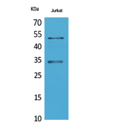 Western blot - MyoD Polyclonal Antibody from Signalway Antibody (41730) - Antibodies.com