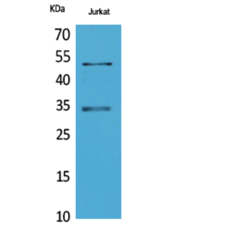 Western blot - MyoD Polyclonal Antibody from Signalway Antibody (41730) - Antibodies.com