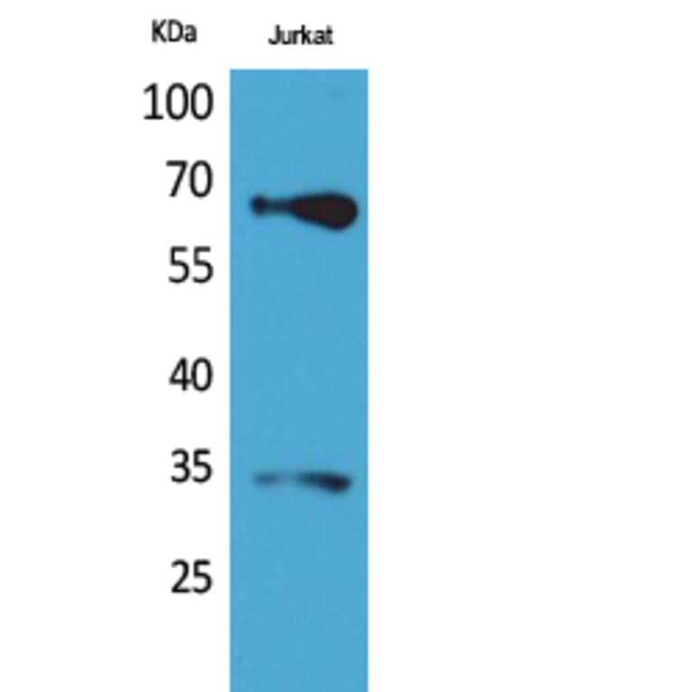 Western blot - Nrf2 Polyclonal Antibody from Signalway Antibody (41731) - Antibodies.com