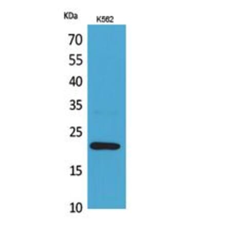 Western blot - IL-6 Polyclonal Antibody from Signalway Antibody (41739) - Antibodies.com